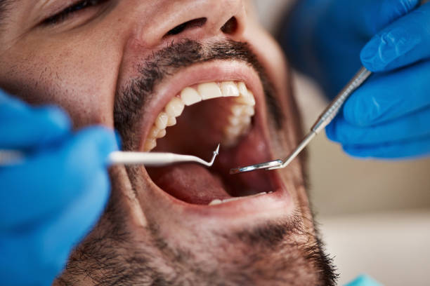 Emergency Dental Services in North Olmsted, OH